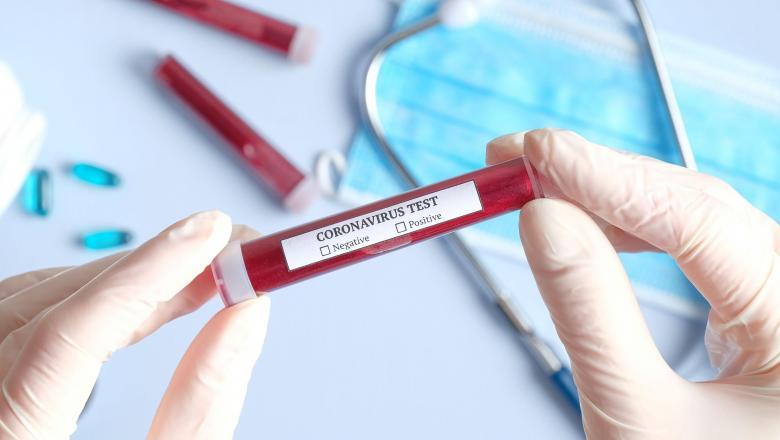 test coronavirus