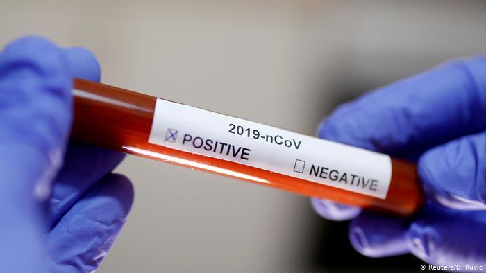 teste coronavirus