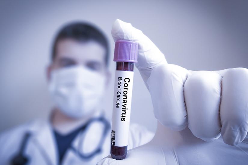 coronavirus-covid-19
