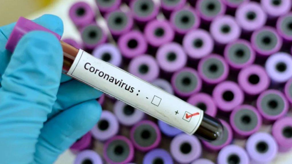 CORONAVIRUS