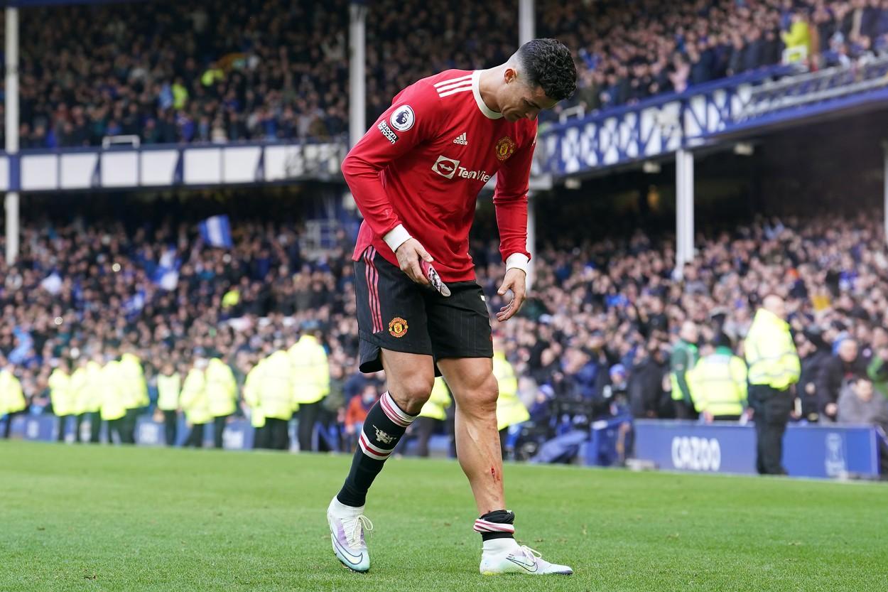 Ronaldo și rănile cu care s-a ales după meciul cu Everton, sursă foto: Profimedia