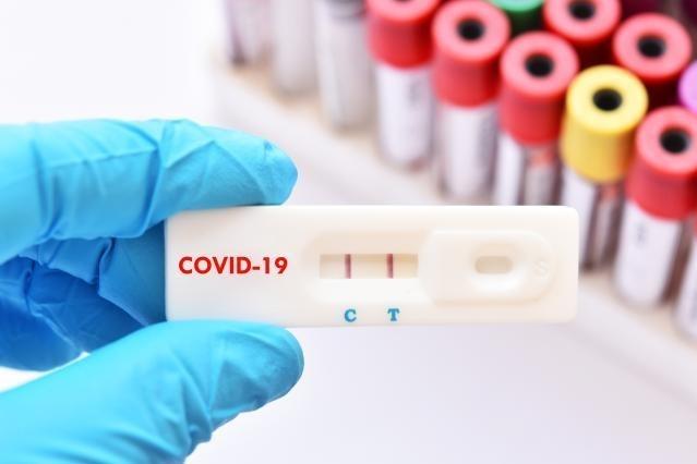 Teste Covid 19 antigen