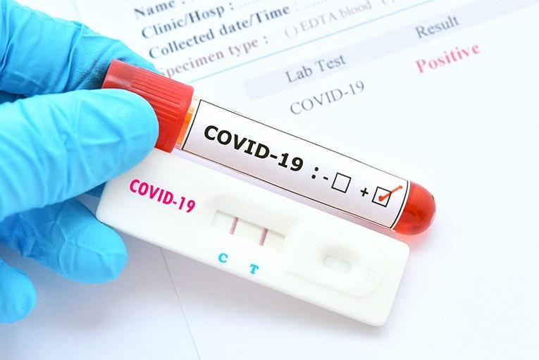 Test coronavirus